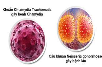 Phân biệt giữa bệnh lậu và chlamydia thế nào